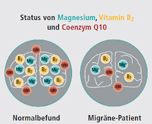 Ionen - Energiestoffwechsel im Gehirn